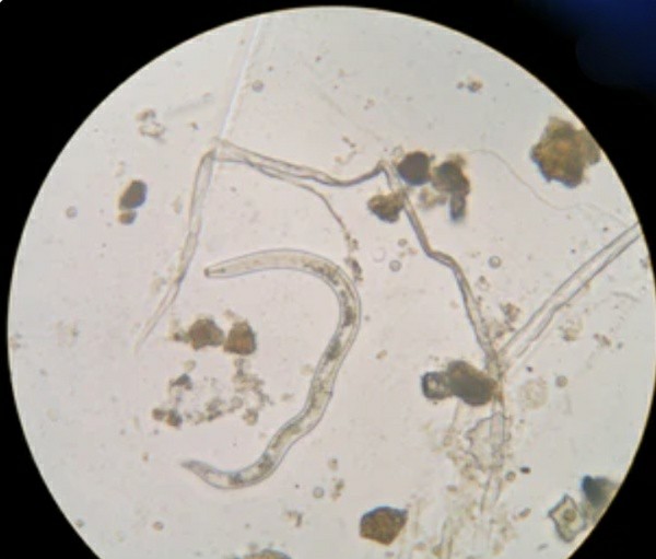 The morphology of nematodes under microscope.