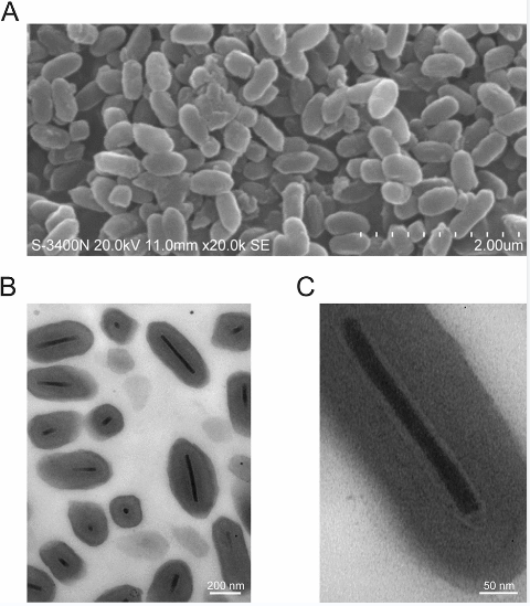 Structure observation of the Mythimna (formerly Pseudaletia) unipuncta granulovirus Hawaiian strain