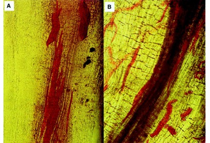 Nematodes ang eggs stained with red food color in diseased root tissue.