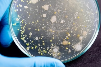 Microorganism Profiling Analysis