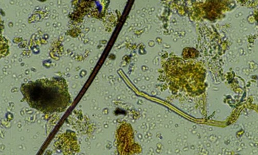 Plant Nematodes