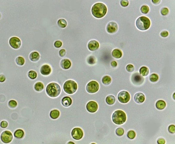 Photomicrograph of the young and mature vegetative Chlorella sp.