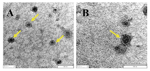 Figure 2. Transmission electron microscopy results. Yellow arrows: exosomes. (X. Wu et al., 2019)
