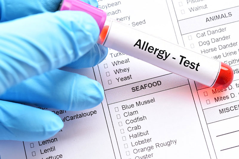 Allergens Testing
