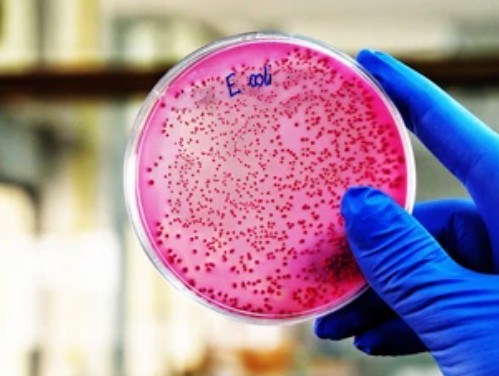 Construction of Engineered Strains of Riboflavin E. coli