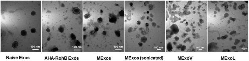 Figure 1. Electron-microscopic observation of milk exosomes. (Zhong et al. 2021)