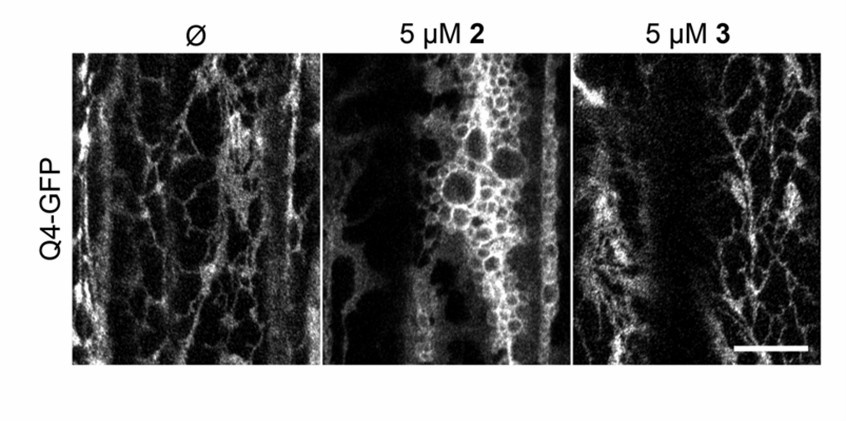 Endoplasmic reticulum structure of Arabidopsis hypocotyl epidermal cells labeled with GFP-Q4.