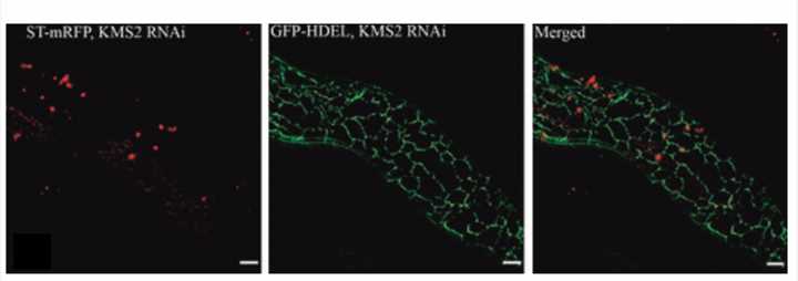 The endoplasmic reticulum network contract as perform of KMS2 RNAi in Arabidopsis hypocotyls.