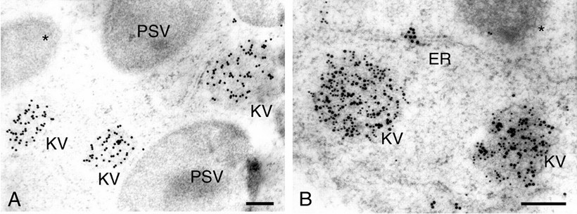 Electron photographs showing that KV is immunogold labeled with antibody to KDEL sequence.