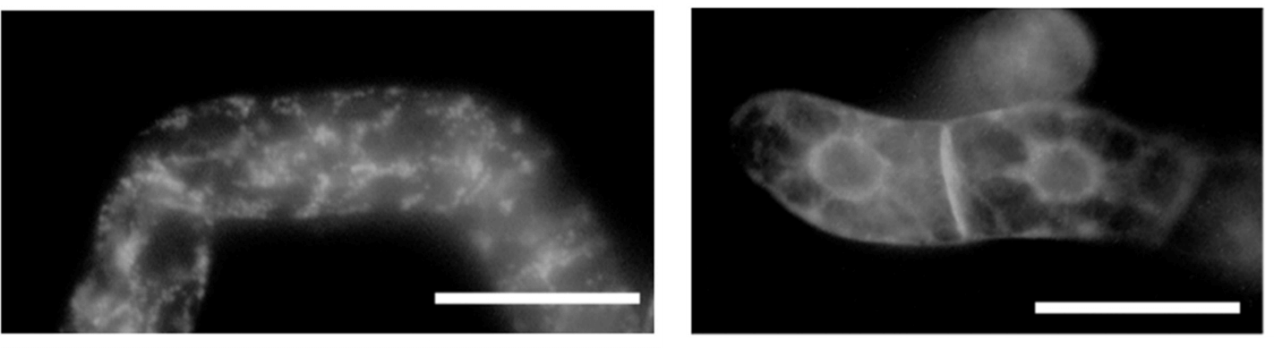 Intracellular localization of SP-GFP-SHEP or SP-GFP-SHEPΔKDEL in tobacco BY-2 cells.