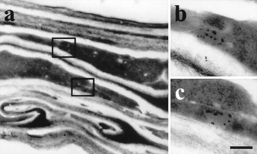 Identification of ricinosomes in developing Ricinus seeds in the collapsed cells by labeling with α-Cys-EP antibody.