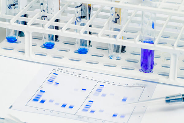 Gene Expression Profiling