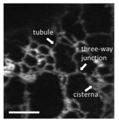 Confocal microscopic image of the cortical ER region of tobacco leaf epidermal cells.