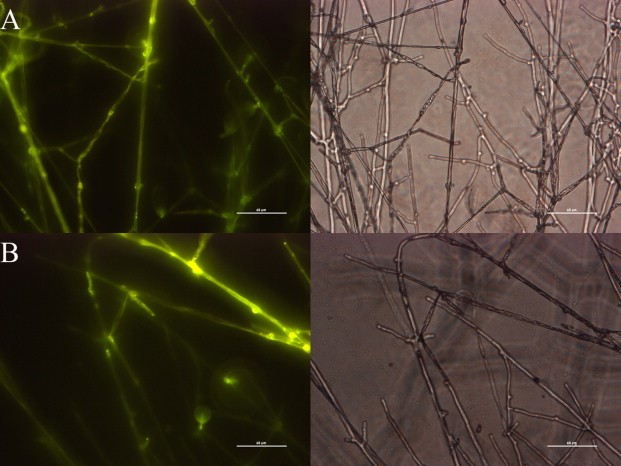 Expression of eGFP in separate P. ostreatus transformants without (A) or with (B) hygromycin.