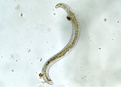 Development of Toxic Protein from Entomopathogenic Nematodes Symbiotic Bacteria